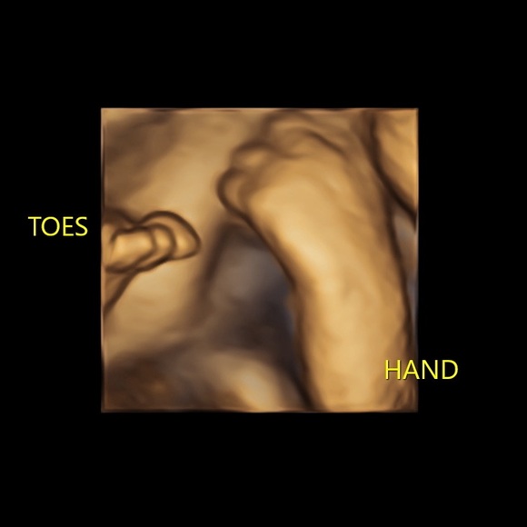 “At The End of Every Storm Is a Rainbow” - Picture 3 of 17